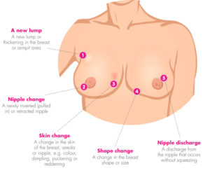 breast-cancer