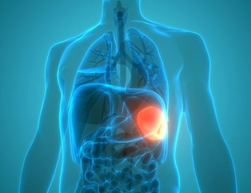 рд╕реНрдкреНрд▓реАрдиреЛрдореЗрдЧрд╛рд▓реА (рддрд┐рд▓реНрд▓реА рдХрд╛ рдмрдврд╝рдирд╛) рдХрд╛ рдЖрдпреБрд░реНрд╡реЗрджрд┐рдХ рдЙрдкрдЪрд╛рд░ тАУ рд╣рд┐рдВрджреА рдореЗрдВ рдЬрд╛рдирдХрд╛рд░реА Spleen Anatomy